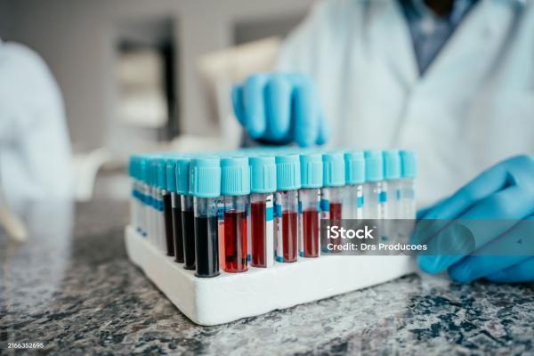 Как подготовиться к сдаче анализов, чтобы результаты были достоверными